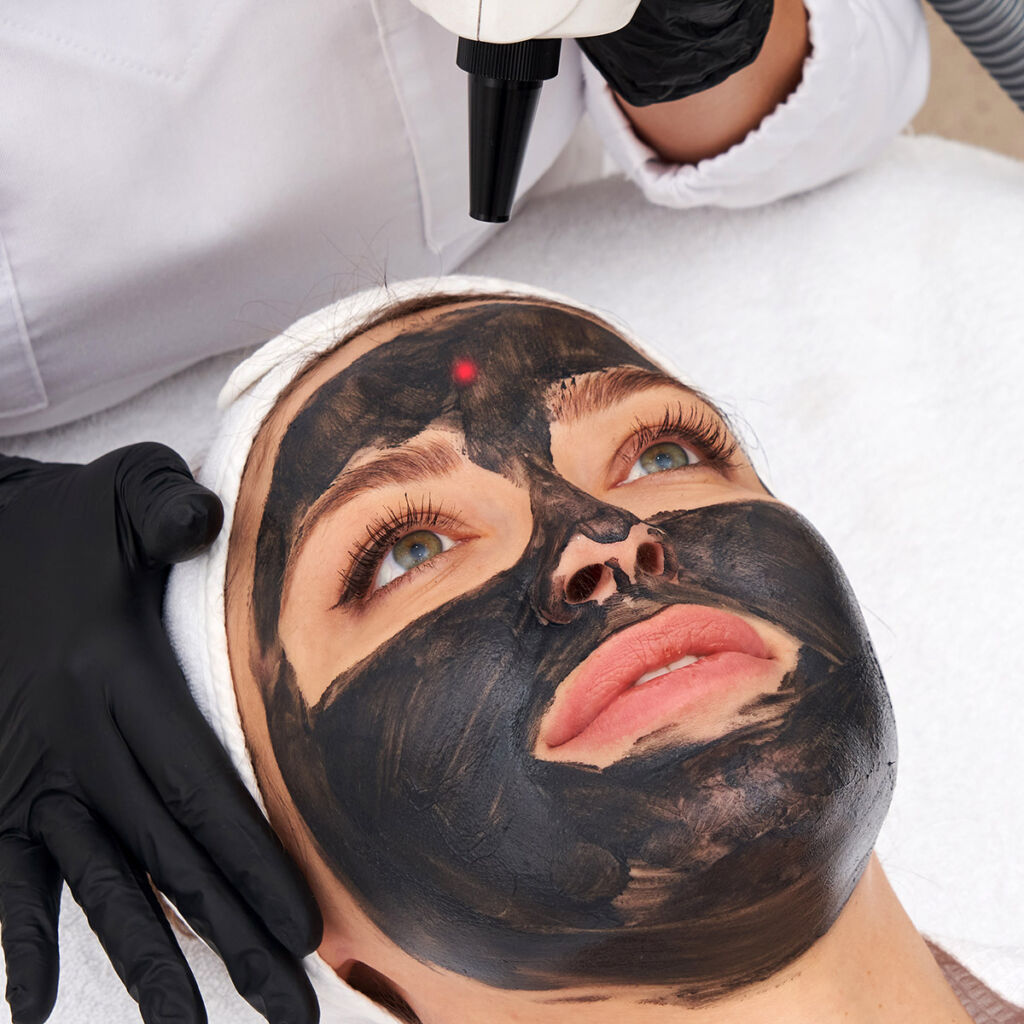 Carbon-facial-at-Envy-Aesthetics